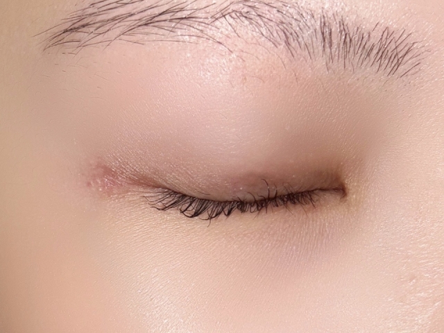 【理事長ブログ】白内障手術は片目だけ受けられる?片目だけ白内障になった場合の原因や治療法